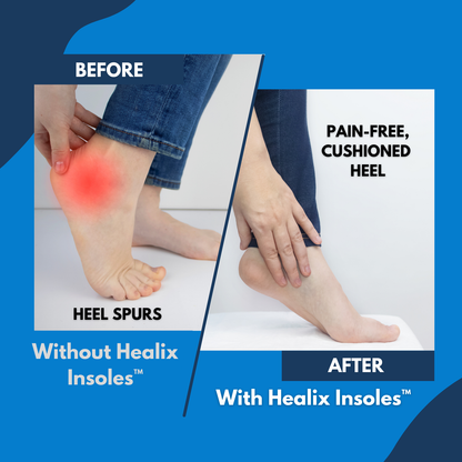 Healix Insoles: Relieve Pain & Protect Your Joints