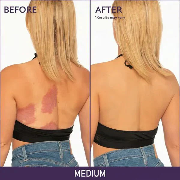 🎁SOFT MATTE CREAM CONCEALER