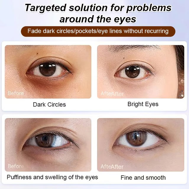 Anti-wrinkle eye serum oil